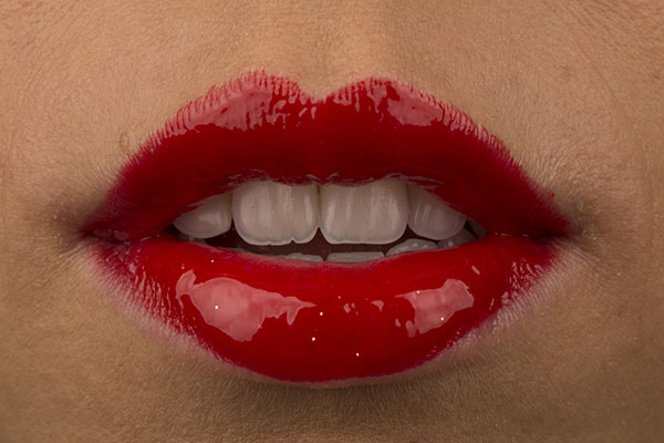 disenos-de-sonrisa