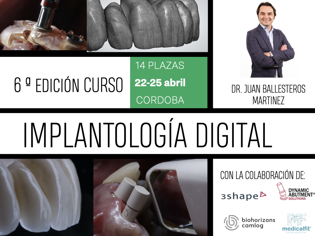 6 ª IMPLANTOLOGIA DIGITAL.001