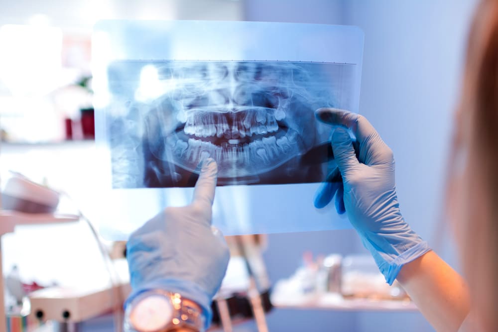 ¿Cuántas radiografías dentales se pueden hacer al año sin riesgos?