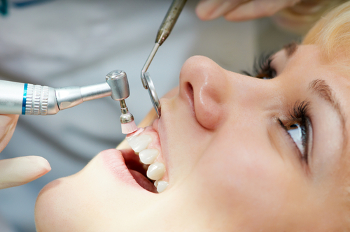 Qué es y cómo funciona la profilaxis dental