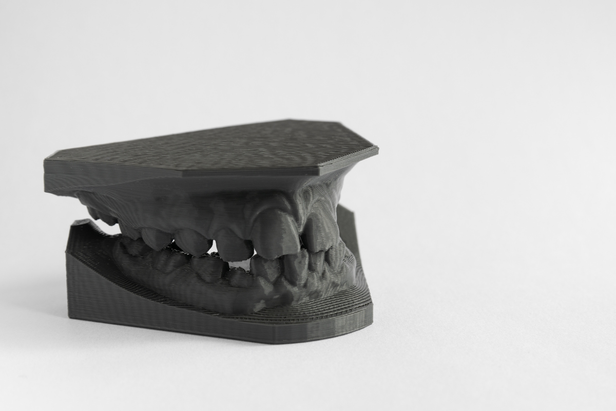 Las grandes posibilidades de la impresora 3D en odontología - Clínica La Victoria