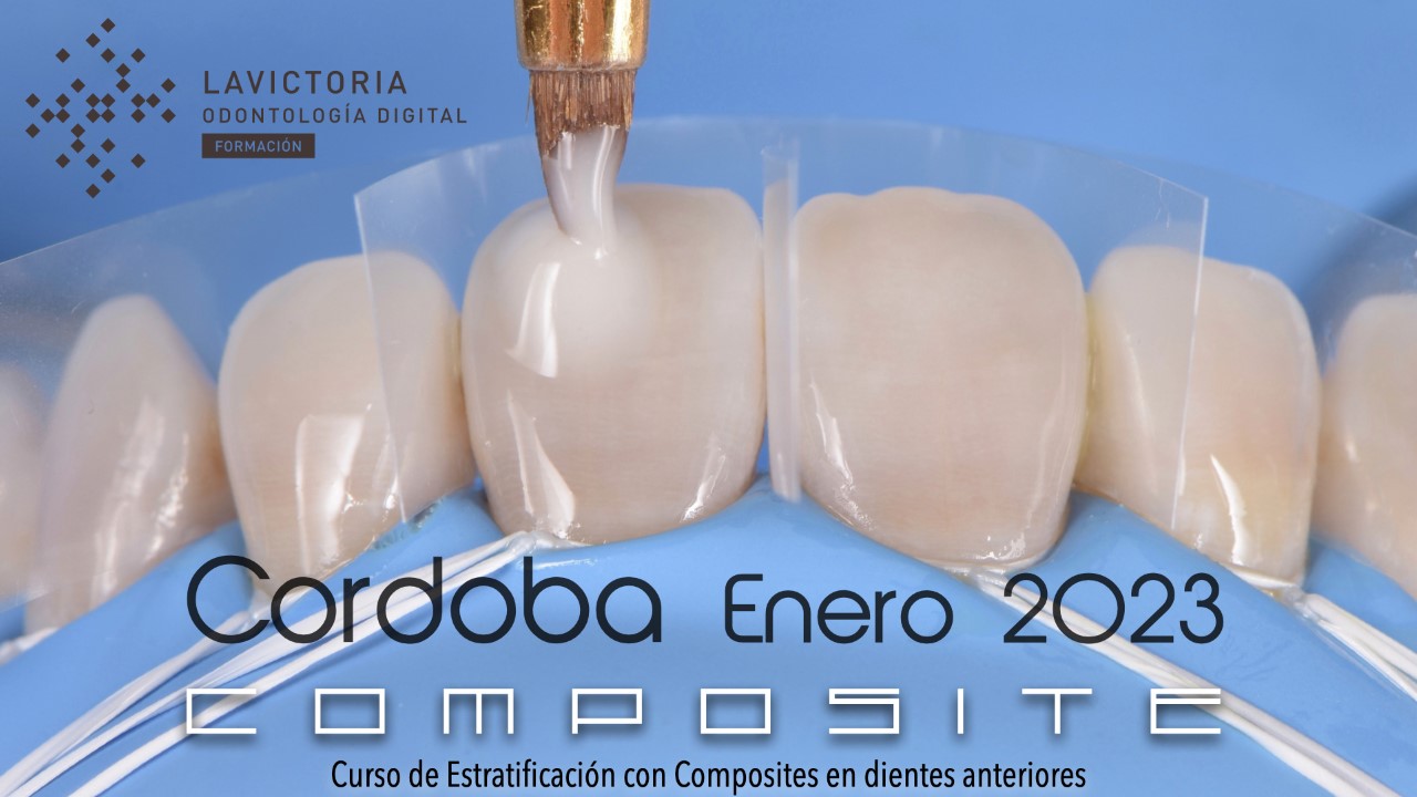 Curso de estratificación en composites en dientes anteriores- Clínica La Victoria