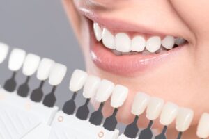 La obsesión por los dientes blancos: la blancorexia - Clínica La Victoria